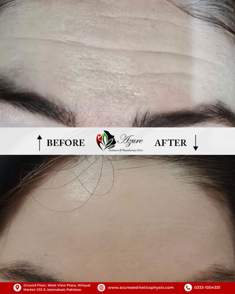 Before-After-1