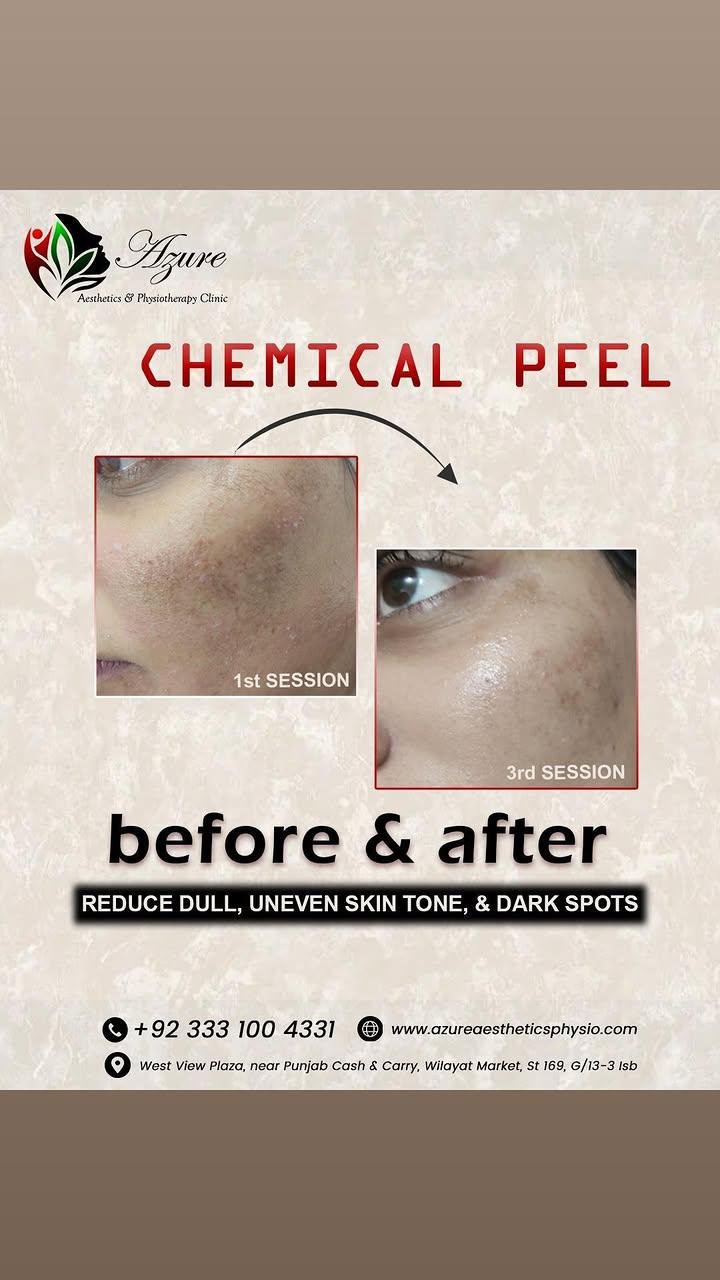 Before and after