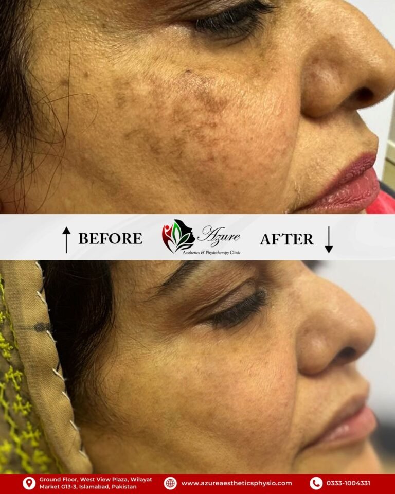 before and after